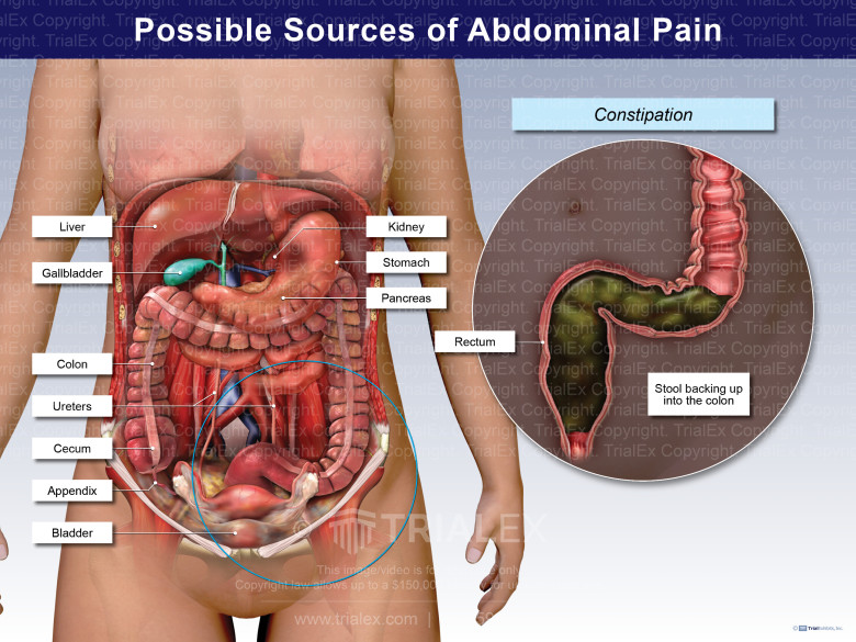 Abdominal Pain Location Diagram 2500x1404
